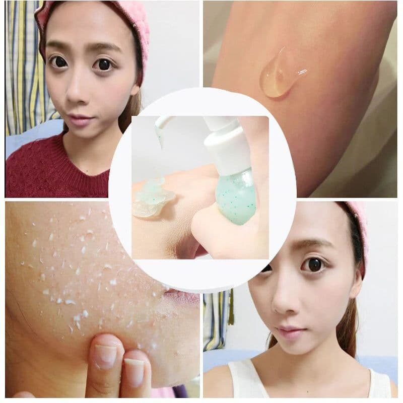 image-Fruit Acid Peeling Gel 120ml Facial Cleansing Exfoliating Peeling Scrub Deep Clean Acne Blackhead Remove Face Cleanser