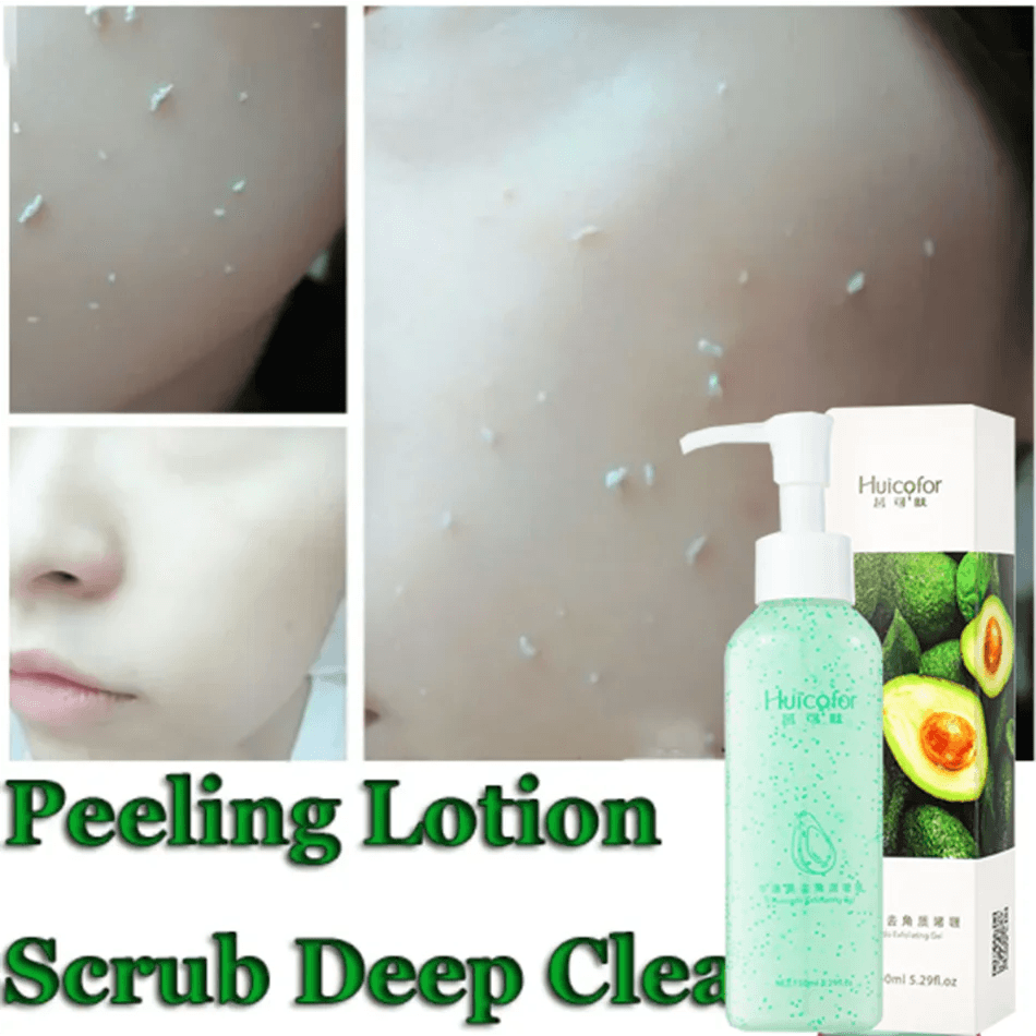 image-Fruit Acid Peeling Gel 120ml Facial Cleansing Exfoliating Peeling Scrub Deep Clean Acne Blackhead Remove Face Cleanser
