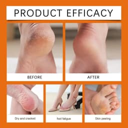 image-Honey Moisturizing Stick for Hand Foot Skin Care Deep Hydrating Anti Drying Chapping Soften Calluses Heel Cracked Repair Cream