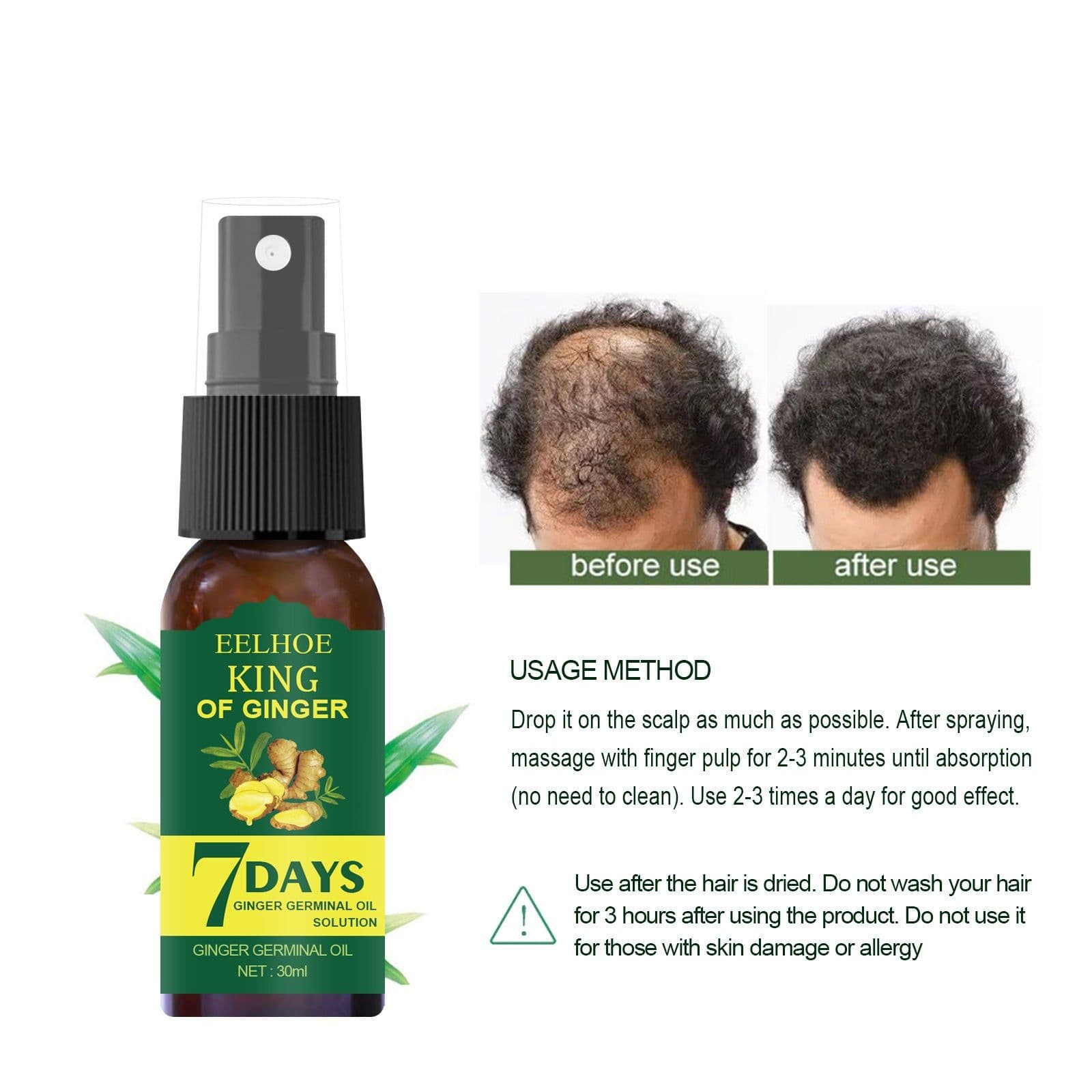 image-EELHOE Foreign Trade Cross-border Ginger Nutrition Spray Ginger Hair Root Spray Moisturizing Hair Hair Care Spray Spray