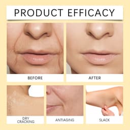 image-Body Skin Cream Moisturizing And Nourishing Face