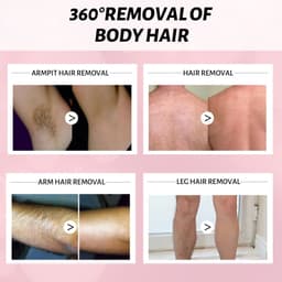 image-30ml 100ml Hair Removal Spray Depilatory Armpit Hair And Legs Hair Foam Mousse And Removal Is Gentle Hair Cream Spray Non-irritating