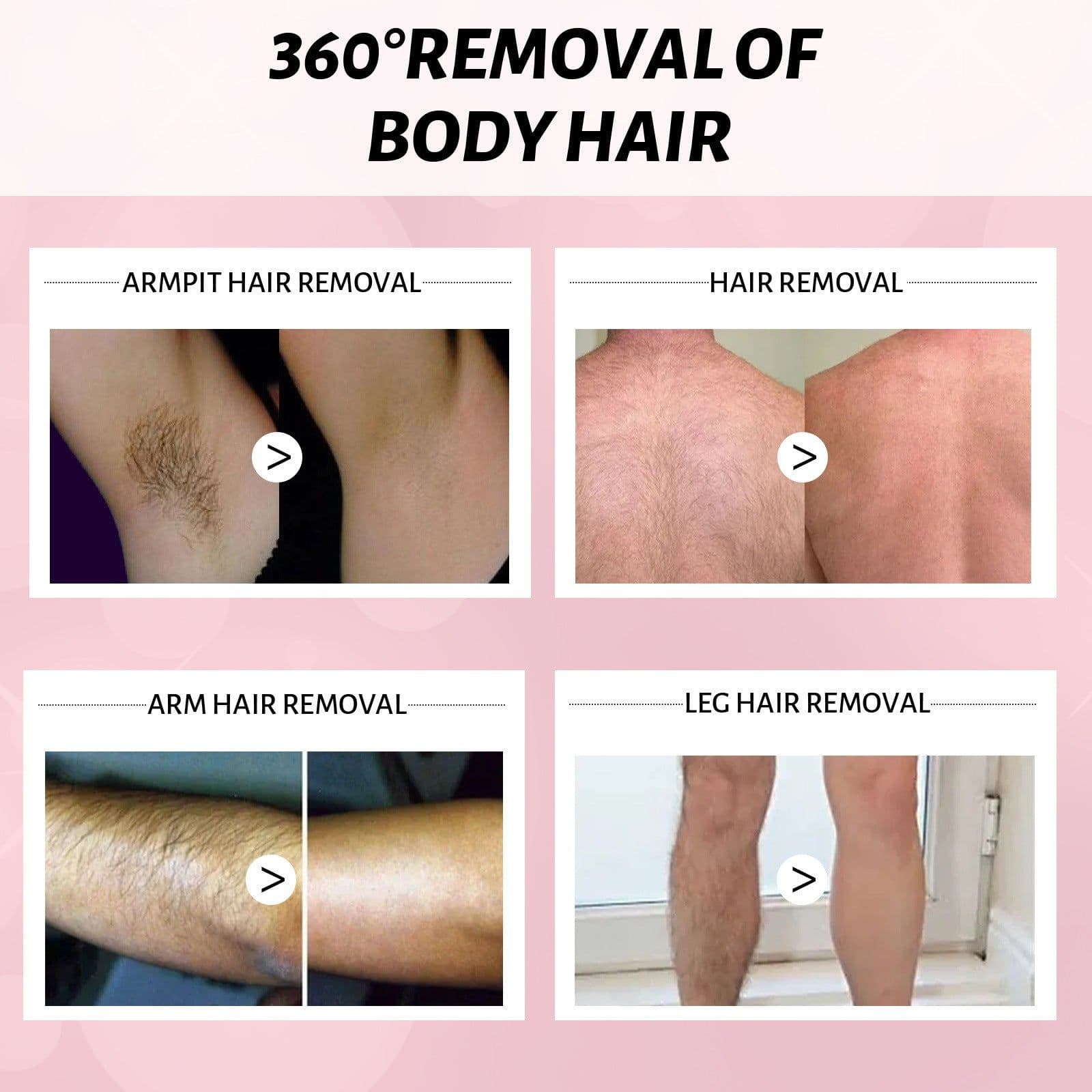 image-30ml 100ml Hair Removal Spray Depilatory Armpit Hair And Legs Hair Foam Mousse And Removal Is Gentle Hair Cream Spray Non-irritating