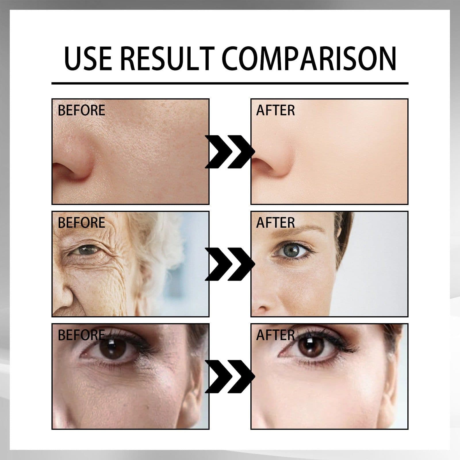 image-Snail Cream Fading Wrinkle French Lines Replenishment Firming Skin Anti-Aging