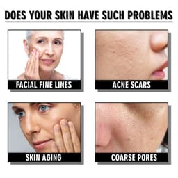 image-Snail Cream Fading Wrinkle French Lines Replenishment Firming Skin Anti-Aging