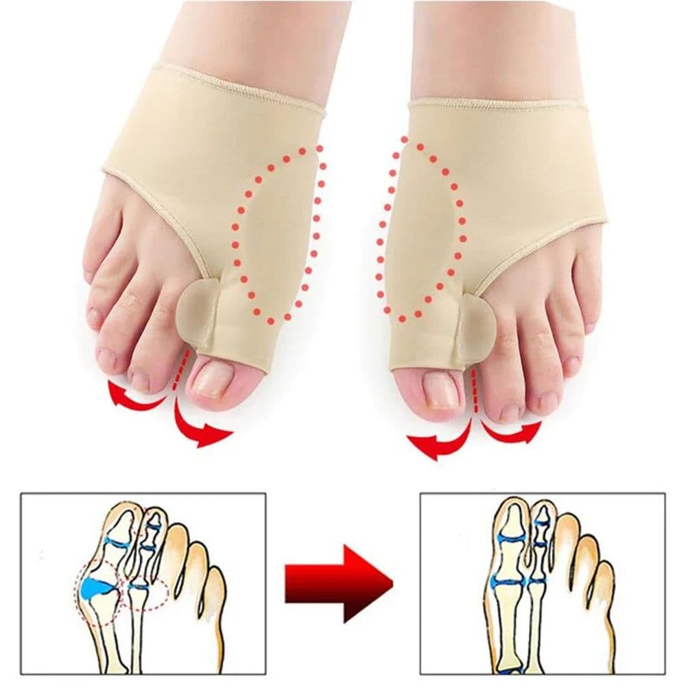image-1Pair Toe Separator Hallux Valgus Bunion Corrector Hammer Toe Straightener Foot Pain Relief Orthopedic Pedicure Tools Foot Care
