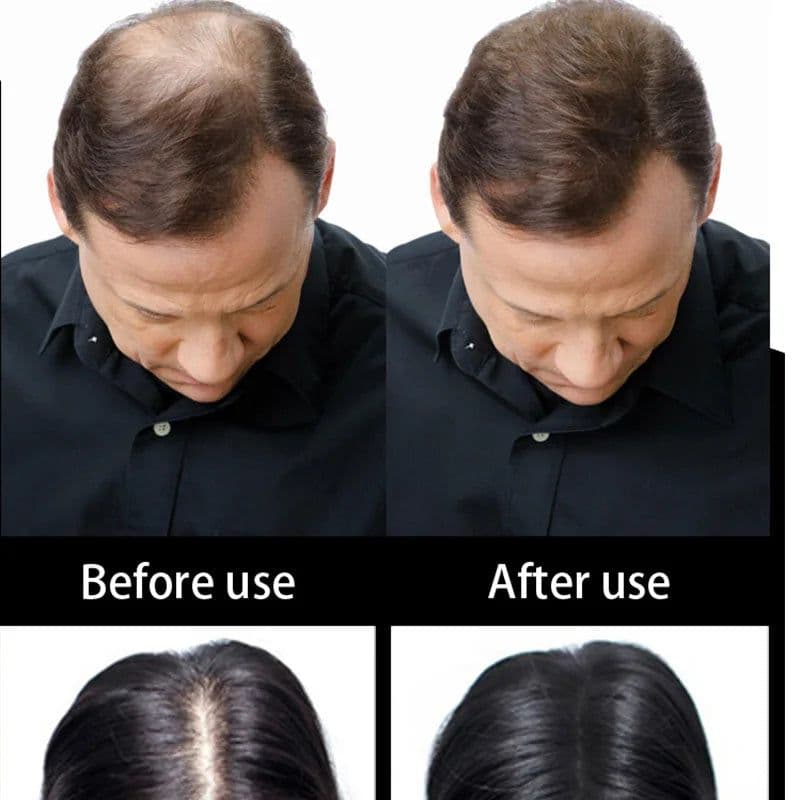 image-Beauty Salon Instant Thickening Hair Fiber Powder Thickening Hair Fibers Building Wig Extensions Refill Black Colors 100g
