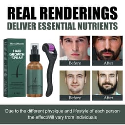 image-West&Month Beard Growth Spray 30ml