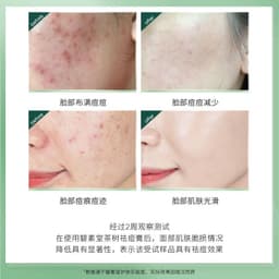 image-Bisutang Tea Tree Acne Cream Control Oil Moisturizing