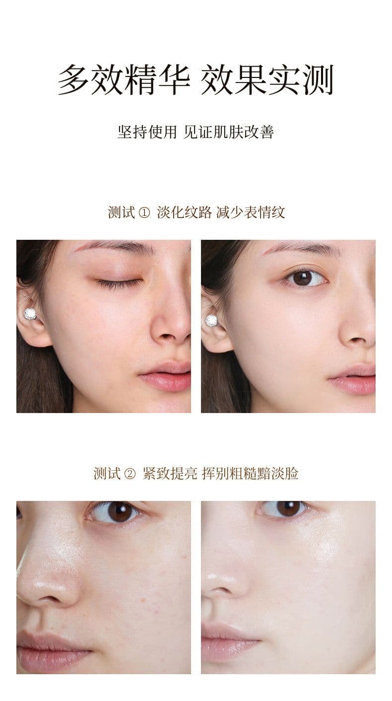 image-HIH Gold Protein Line Carving Skin Care Kit