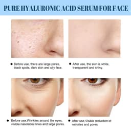 image-EELHOE Hyaluronic Acid Essence Anti-Aging Facial