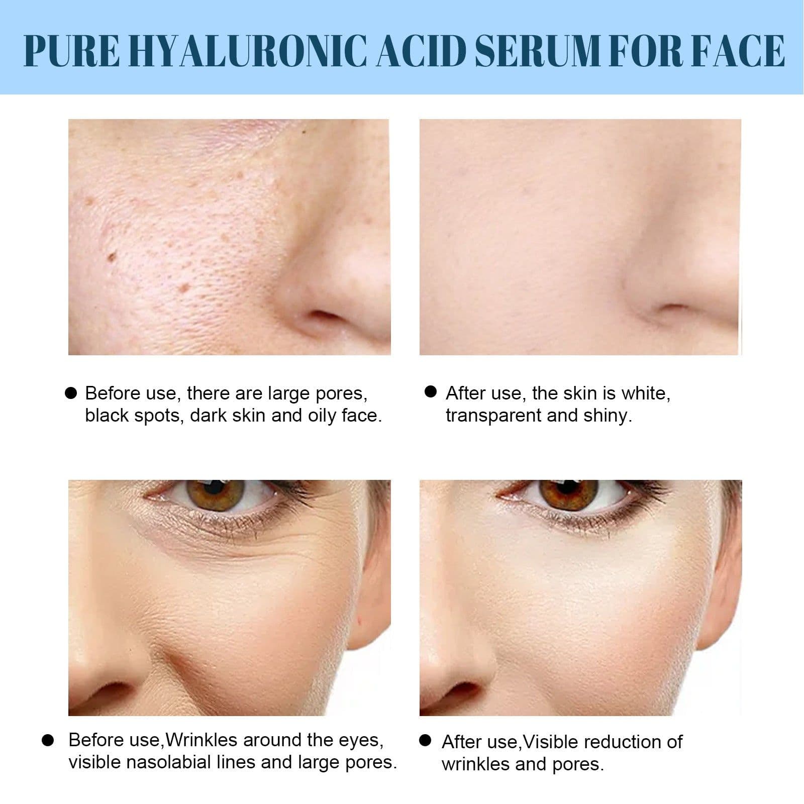 image-EELHOE Hyaluronic Acid Essence Anti-Aging Facial