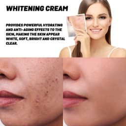 image-Natural Transparent Skin Rejuvenation Skin Moisturizing Skin Beauty Cream