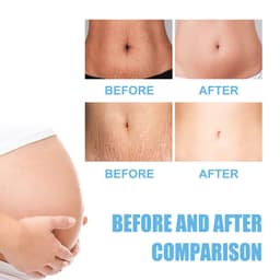 image-Moisturizing Skin Rejuvenation Cream