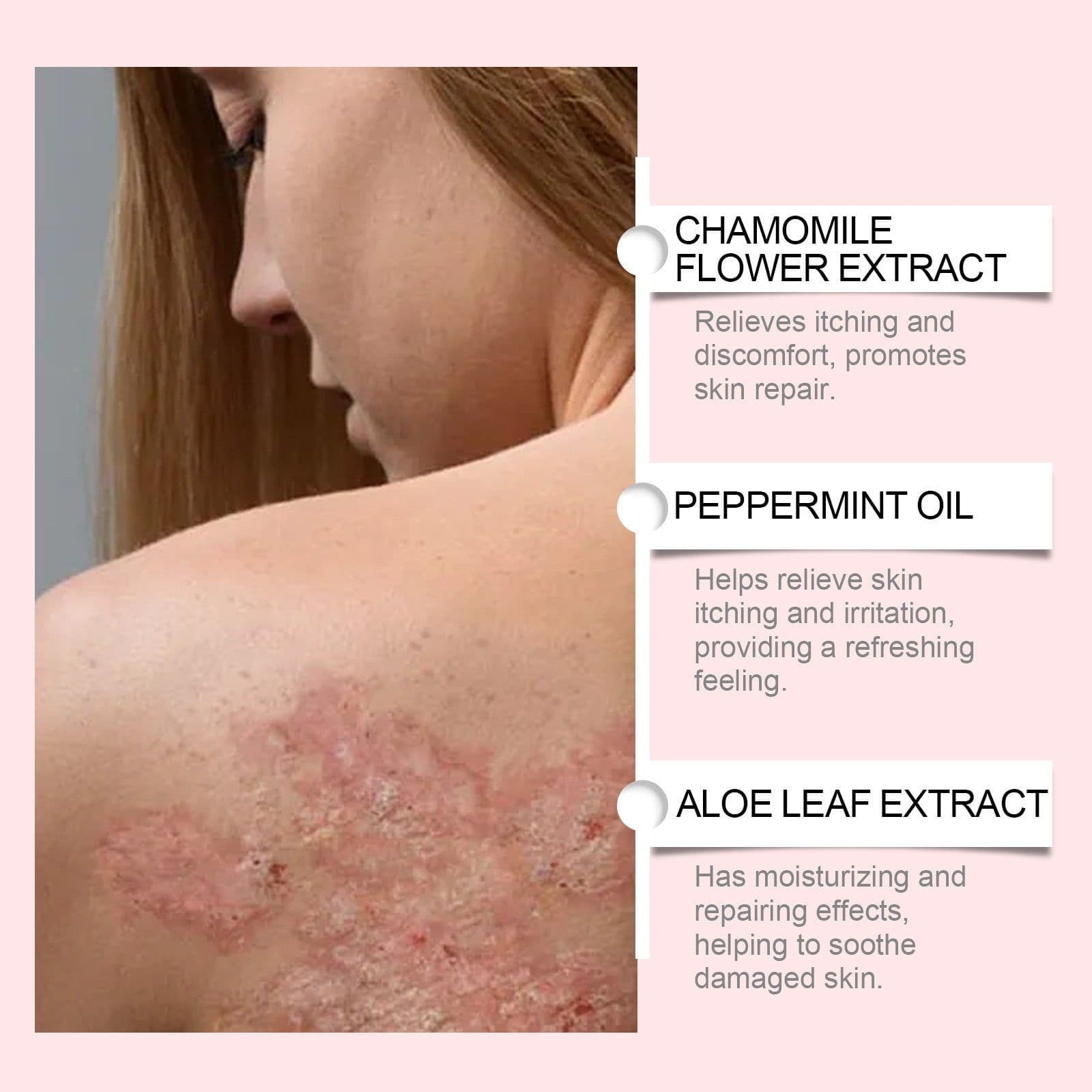 image-Skin Repair Cream Care Nourishing And Improving Skin