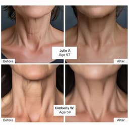 image-Neck Tightening Cream Moisturizes Skin