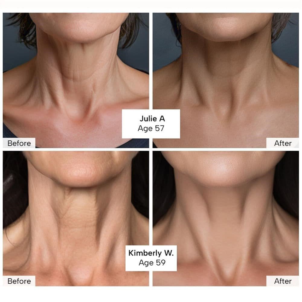 image-Neck Tightening Cream Moisturizes Skin