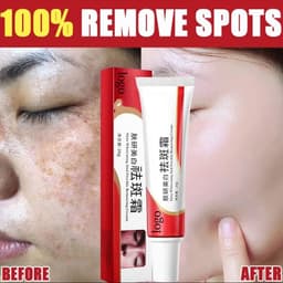 image-Freckle Cream Whitening Skin Universal