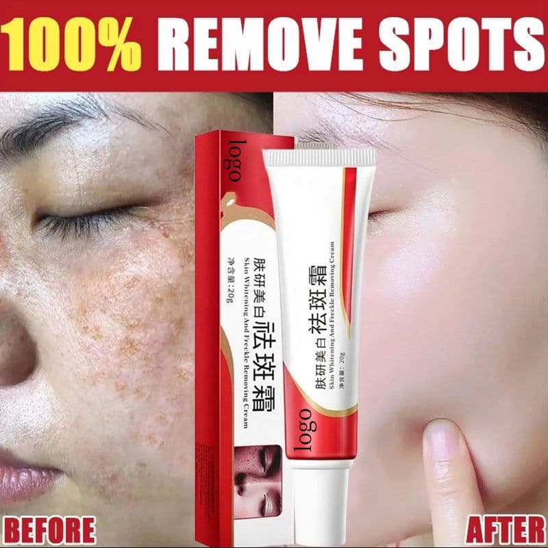 image-Freckle Cream Whitening Skin Universal