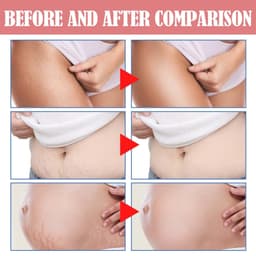 image-Skin Neck Cream Gentle Care Smooth Skin Firming