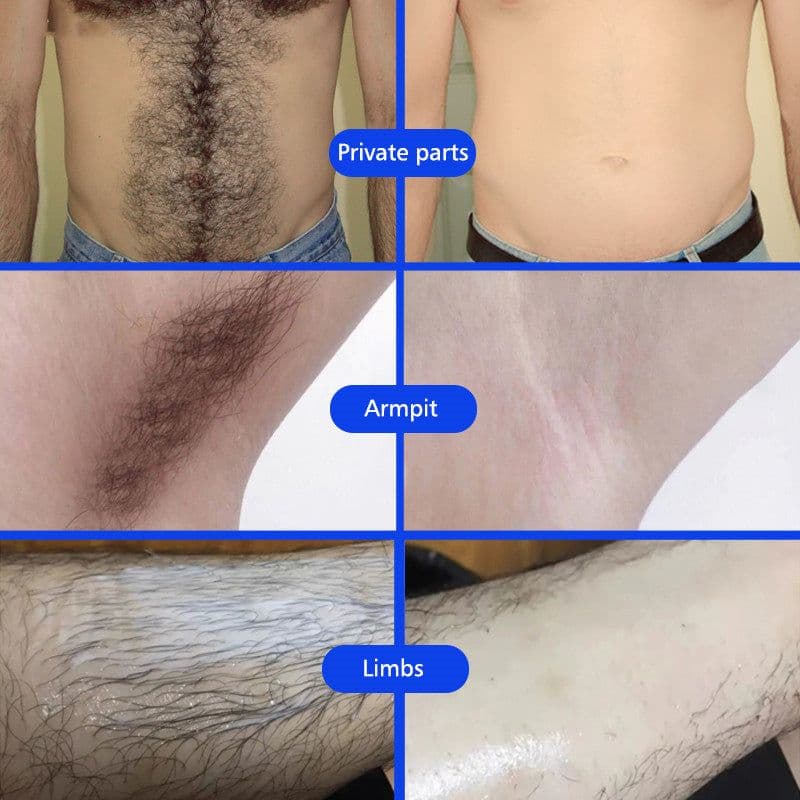 image-Underarm And Leg Skin Care Cream For Men And Women