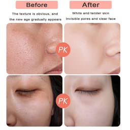 image-Women's Golden Face Cream Moisturizing And Nourishing Skin