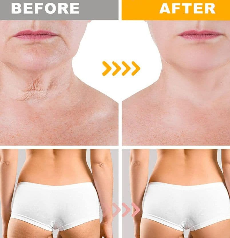 image-Crazylife Bee Venom Dual-purpose Body Face Repair Cream
