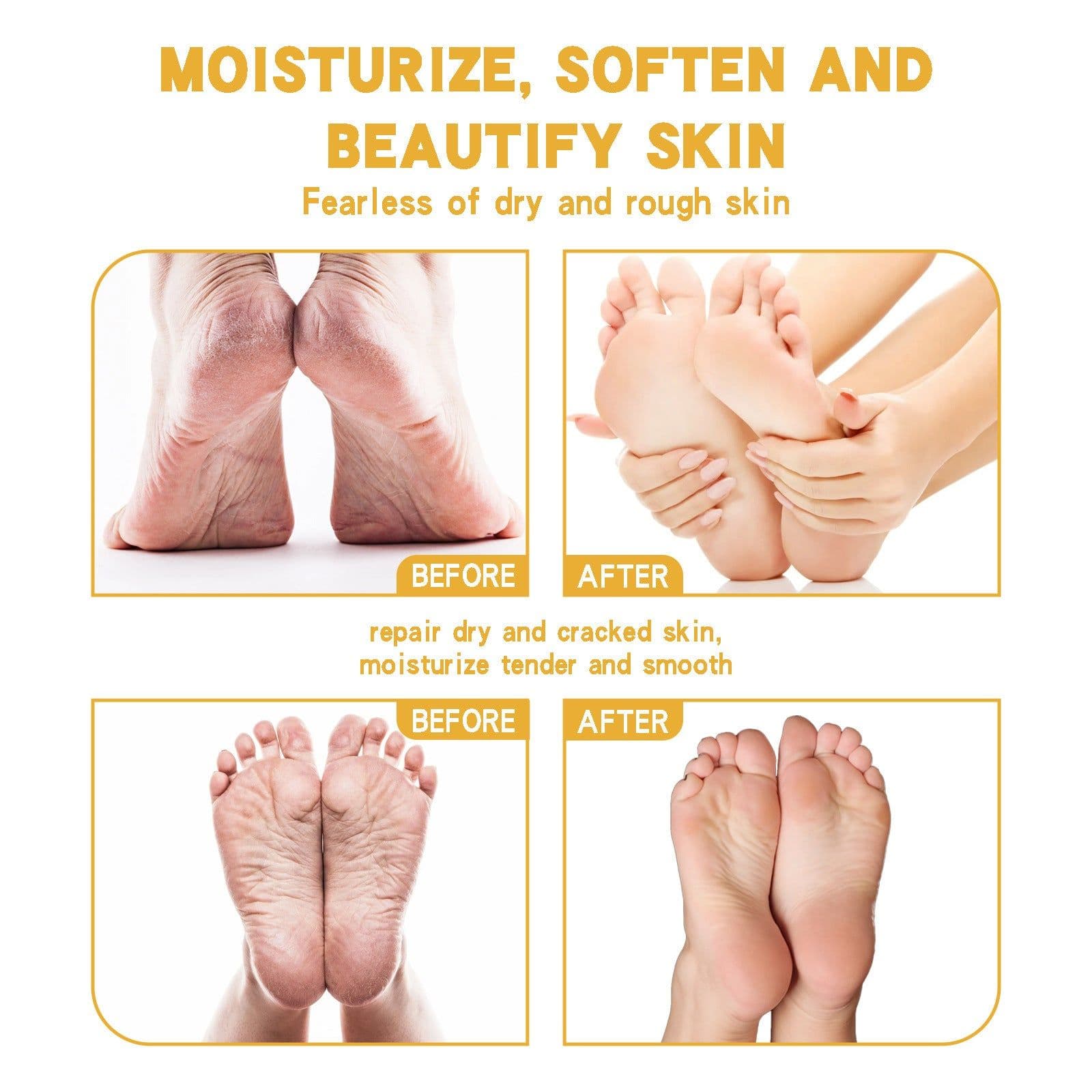 image-Shurun Cream For Chapped Skin Foot Care Moisturizing And Anti-cracking