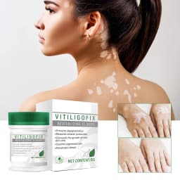 image-White Spot Repair Cream Melanin Repair Even Skin Color For External Use
