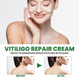 image-White Spot Repair Cream Melanin Repair Even Skin Color For External Use