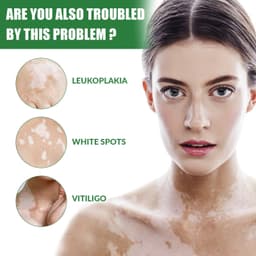 image-White Spot Repair Cream Melanin Repair Even Skin Color For External Use
