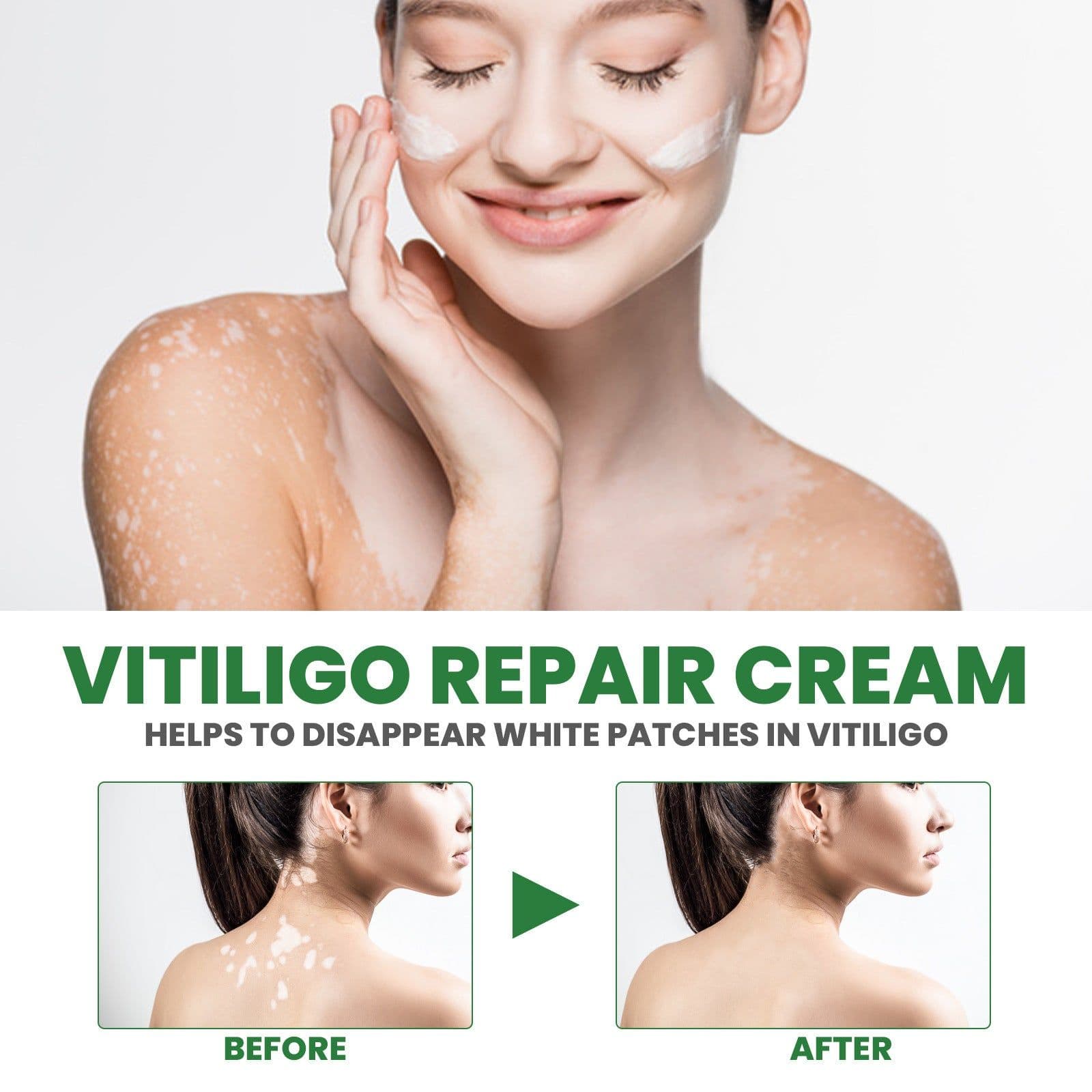 image-White Spot Repair Cream Melanin Repair Even Skin Color For External Use