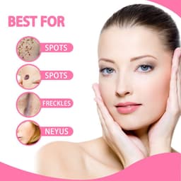 image-Wart Removal Black Mole Essence Removal Mole Repair Plant Essence Mole Removal Essence