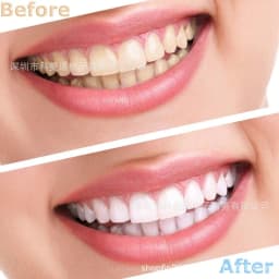 image-Upper teeth and lower teeth simulation braces non-porous braces whitening sleeves second generation silicone artificial teeth dentures factory direct sales