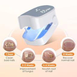 image-Nail Fungus Laser Treatment LED Light Device Effective Rechargeable Nail Fungus Remover Nail Fungus Cleaning Laser Device Repair Damaged Discolored Thick Fingernails