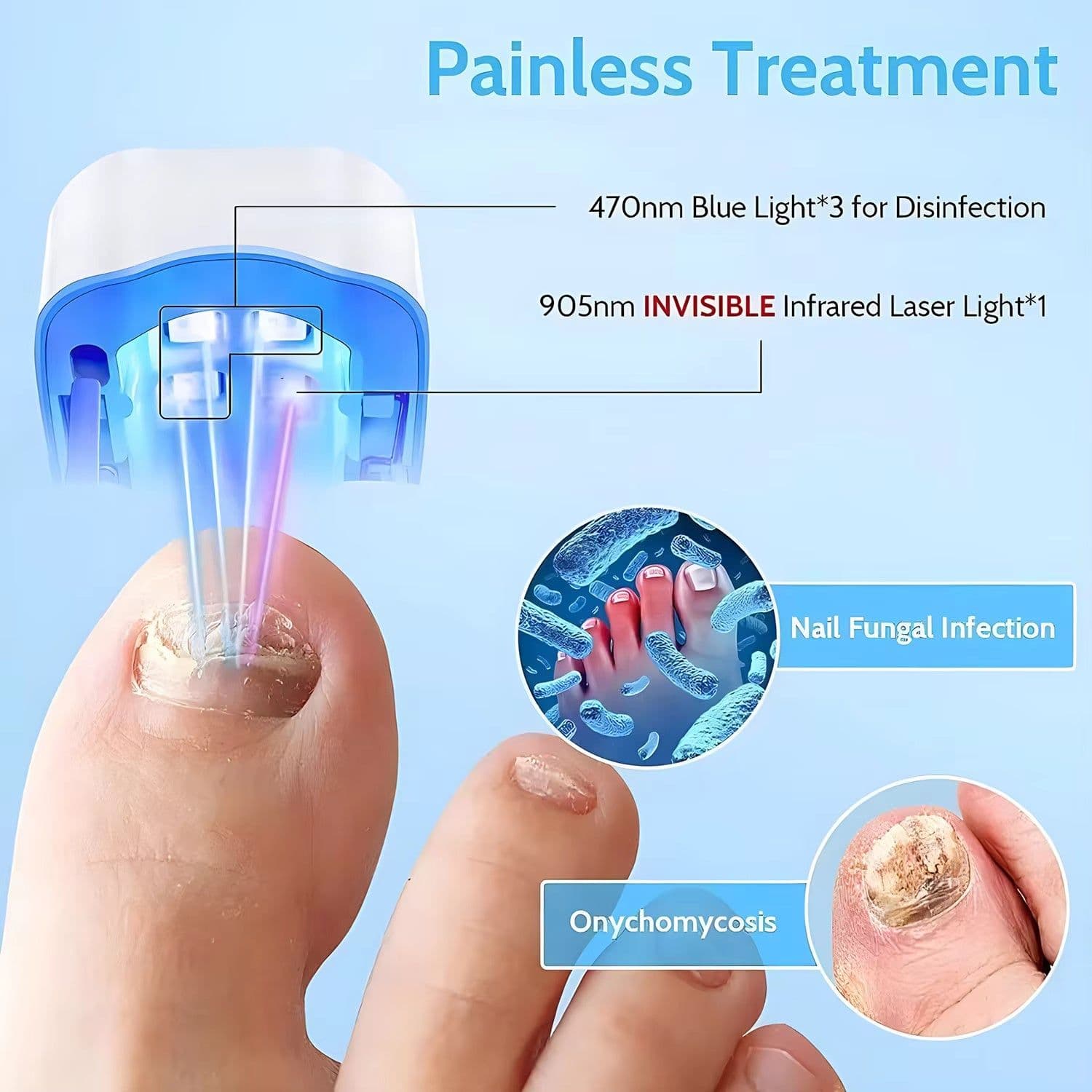 image-Nail Fungus Laser Treatment LED Light Device Effective Rechargeable Nail Fungus Remover Nail Fungus Cleaning Laser Device Repair Damaged Discolored Thick Fingernails