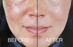 image-Adrien Arpel The Complete Fix Youth Serum