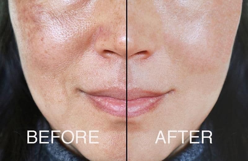 image-Adrien Arpel The Complete Fix Youth Serum