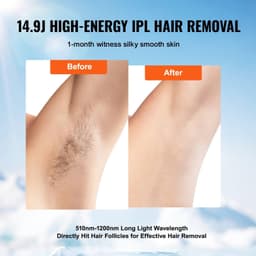 image-VEVOR IPL Hair Removal, Permanent Hair Removal for Women and Men, Auto/Manual Modes & 5 Adjustable Levels, Painless At-Home Hair Removal Device for Legs, Armpits, Bikini Line, Whole Body