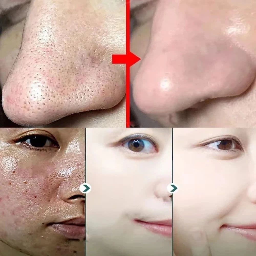 image-Original Facial Remove Blackhead Green Tea Solid Mask Treat Acne Blemish Black Dots Clean Stick Cream Shrink Pores Skin Care
