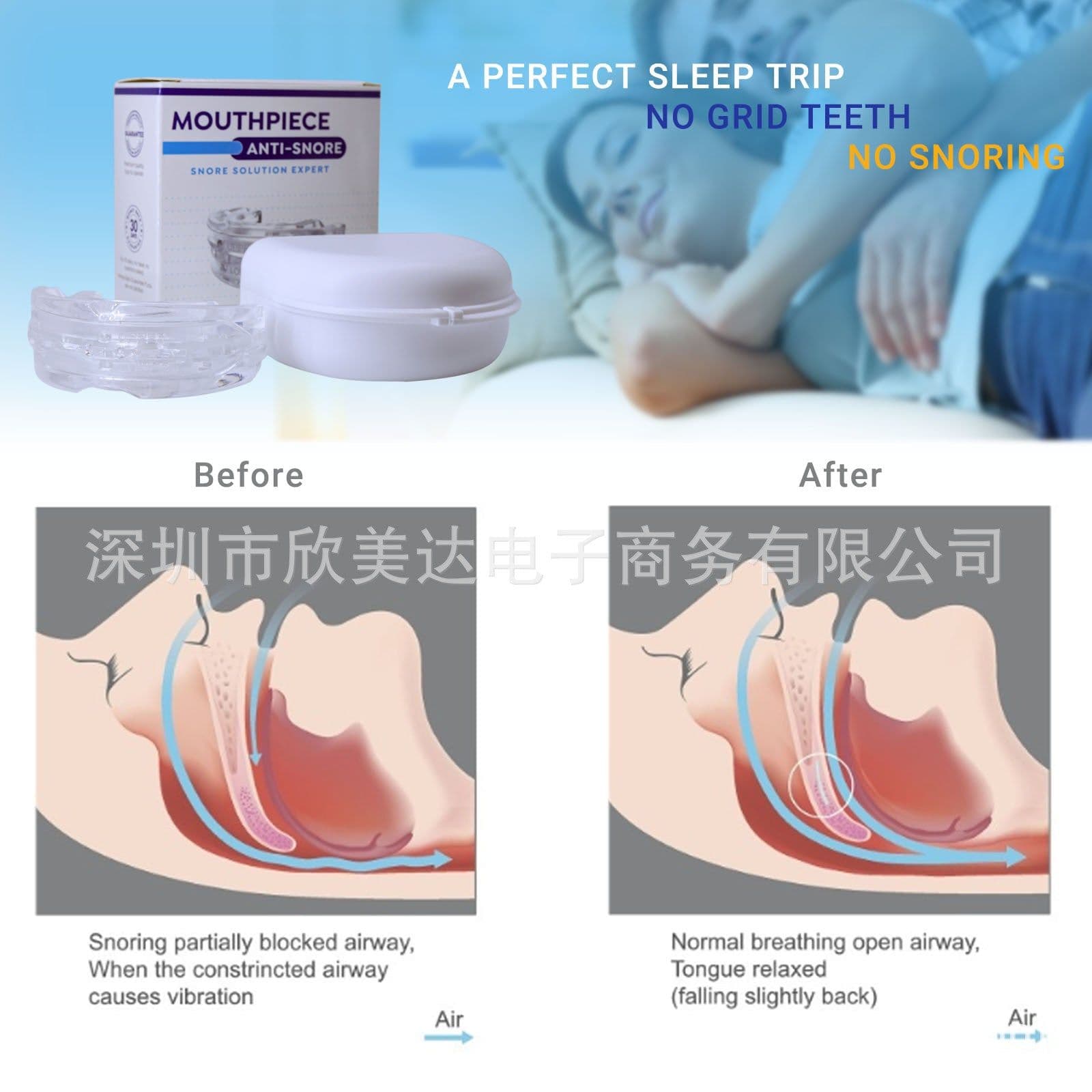 image-Amazon Cross-Border New Adjustable Mouth Trays Sports Braces Nighttime Anti-grinding Trays
