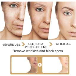 image-EELHOE Turmeric Dark Spot Correction Essence Improves Skin Tone Essence Facial Care Spot Moisturizing