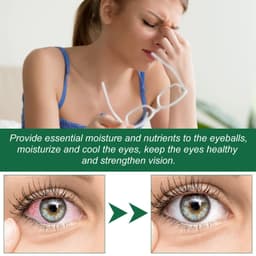 image-Ximonth Eye Drops Relieve Eye Fatigue, Dry Itchy Eyes, Soreness, Swelling, Blurred Vision Care Solution