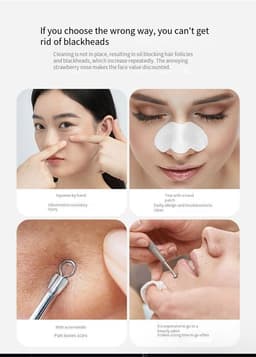 image-Electric Blackhead Remover Cleaner Face Diamond Pore Vacuum Suction
