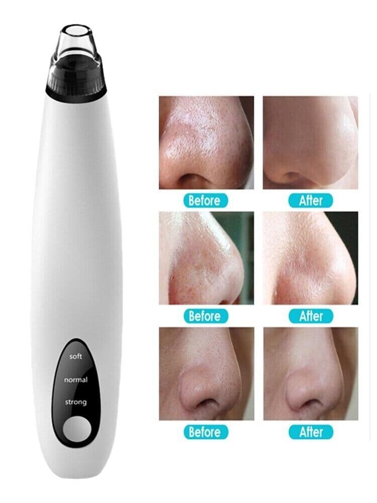 image-Electric Blackhead Remover Cleaner Face Diamond Pore Vacuum Suction
