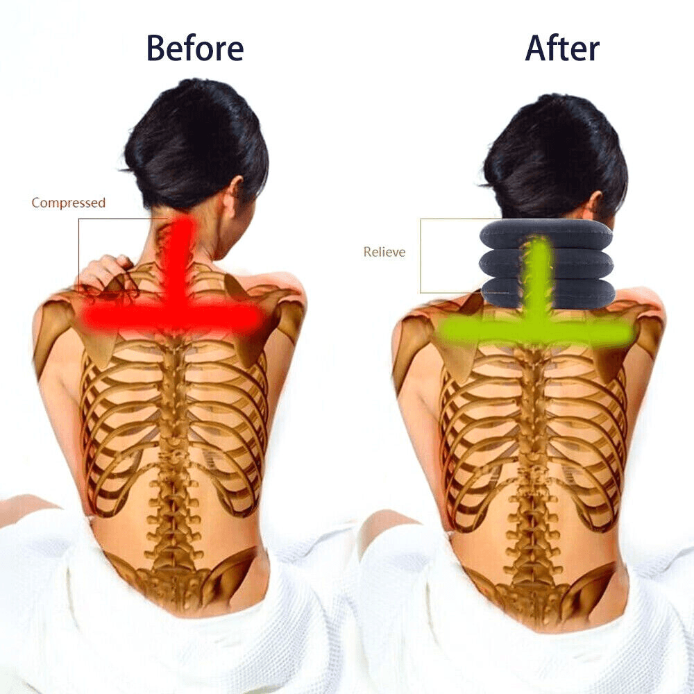 image-Cervical Neck Traction Device Collar Brace Support Pain Relief
