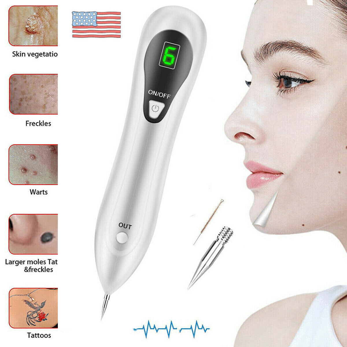 image-Electric Laser Plasma Pen Mole Removal Dark Spot Remover Skin Wart Tag