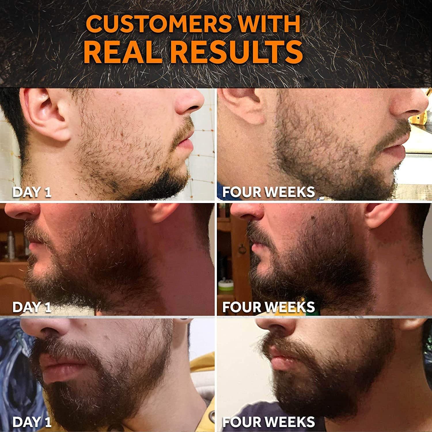 image-Cross-border new products men's beard care kit beard liquid cleaning nutrition care beard kit from stock