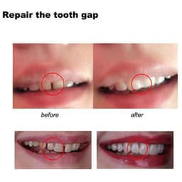 image-Temporary Dental Filling Material Gutta-Percha 50g