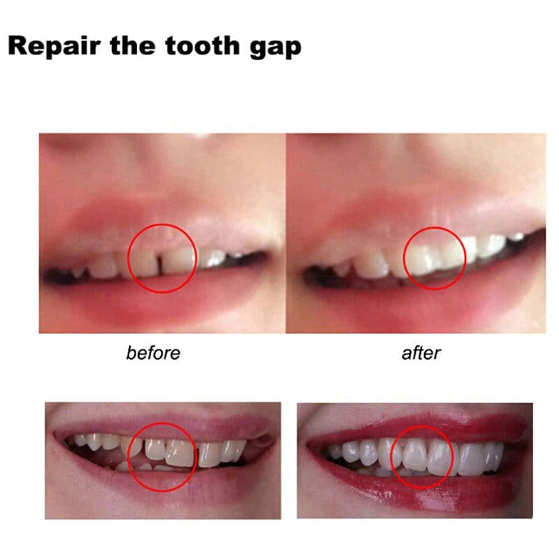 image-Temporary Dental Filling Material Gutta-Percha 50g